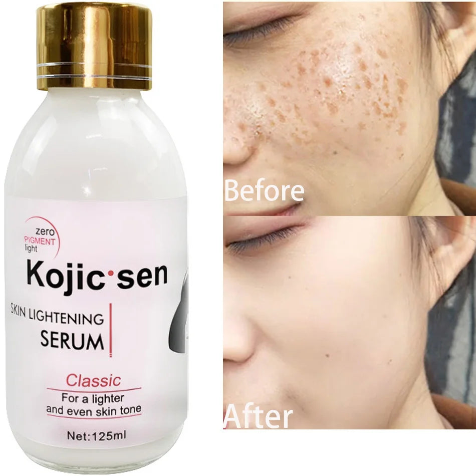 125ml Kojic Sen Concentre With Collagen Serum Strong Brightening Fade Stubborn Dark Spots More Radiant Even Complexion Serum