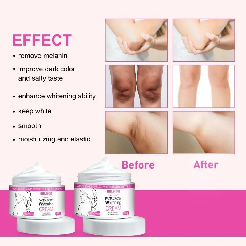 Face Body Brightening Cream Thigh Knees Underarm Inner Melanin Lightening Lotion Feminine Gentle Nourishing Dark Skin Care Cream